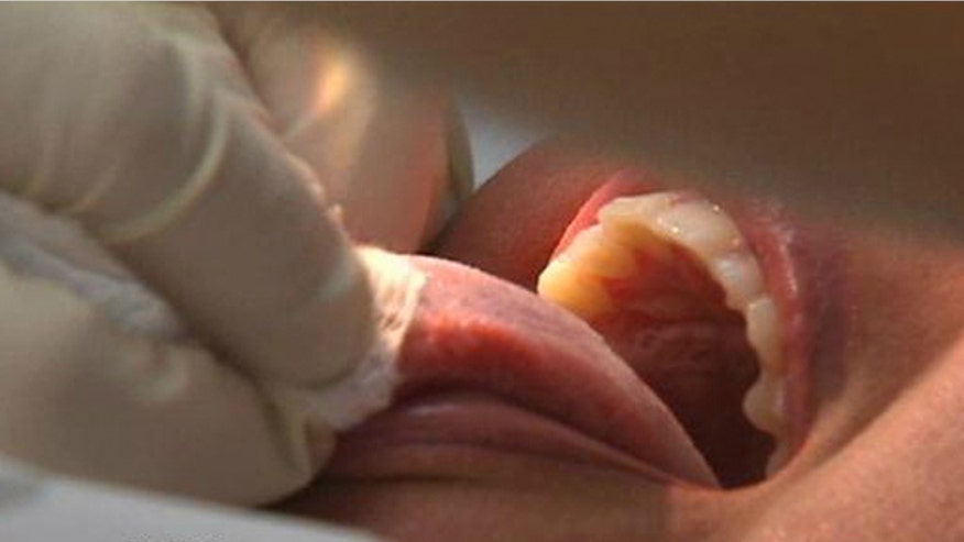 Weight loss tongue patch.jpg